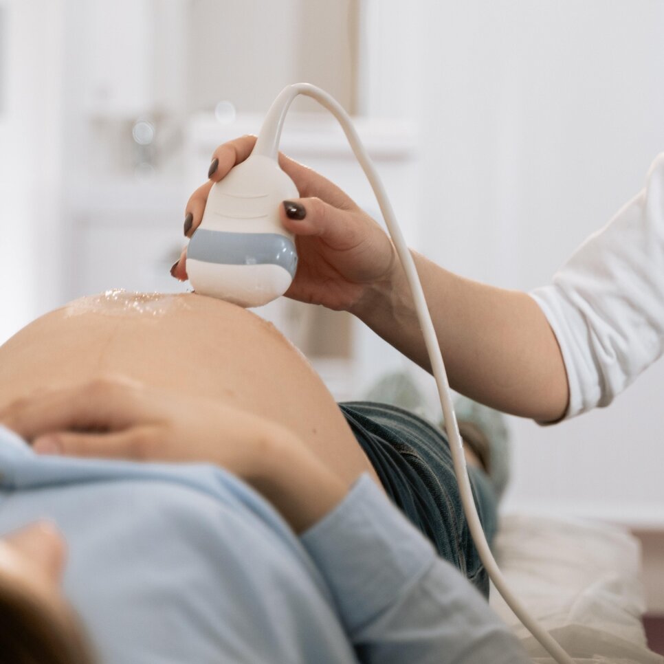 pregnant woman getting an ultrasound